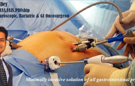 laparoscopic surgery in kolkata